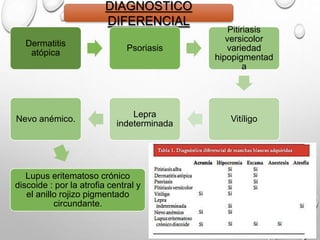 DIAGNOSTICO
DIFERENCIAL
Dermatitis
atópica
Psoriasis
Pitiriasis
versicolor
variedad
hipopigmentad
a
Vitíligo
Lepra
indeterminada
Nevo anémico.
Lupus eritematoso crónico
discoide : por la atrofia central y
el anillo rojizo pigmentado
circundante.
 
