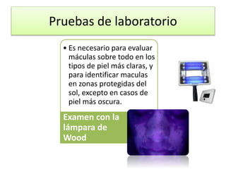 Pruebas de laboratorio
• Es necesario para evaluar
máculas sobre todo en los
tipos de piel más claras, y
para identificar maculas
en zonas protegidas del
sol, excepto en casos de
piel más oscura.
Examen con la
lámpara de
Wood
 