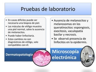 Pruebas de laboratorio
• En casos difíciles puede ser
necesaria una biopsia de piel.
• Las máculas de vitíligo muestra
una piel normal, salvo la ausencia
de melanocitos.
• Puede haber linfocitaria.
• Estos cambios no son
diagnósticos de vitíligo, solo
compatibles con él.
Dermatopatología
• Ausencia de melanocitos y
melanosomas en los
queratinocitos: espongiosis,
exocitosis, vaculopatía
basilar y necrosis.
• Se observó presencia de
linfocitos en la epidermis.
Microscopía
electrónica
 