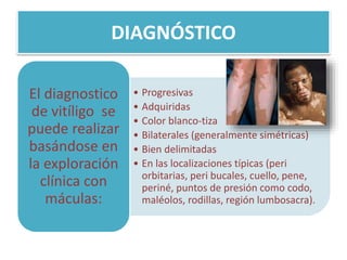 DIAGNÓSTICO
• Progresivas
• Adquiridas
• Color blanco-tiza
• Bilaterales (generalmente simétricas)
• Bien delimitadas
• En las localizaciones típicas (peri
orbitarias, peri bucales, cuello, pene,
periné, puntos de presión como codo,
maléolos, rodillas, región lumbosacra).
El diagnostico
de vitíligo se
puede realizar
basándose en
la exploración
clínica con
máculas:
 