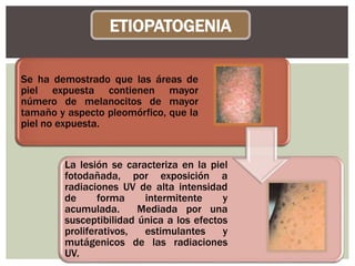 Se ha demostrado que las áreas de
piel expuesta contienen mayor
número de melanocitos de mayor
tamaño y aspecto pleomórfico, que la
piel no expuesta.
La lesión se caracteriza en la piel
fotodañada, por exposición a
radiaciones UV de alta intensidad
de forma intermitente y
acumulada. Mediada por una
susceptibilidad única a los efectos
proliferativos, estimulantes y
mutágenicos de las radiaciones
UV.
ETIOPATOGENIA
 