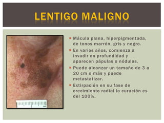 Mácula plana, hiperpigmentada,
de tonos marrón, gris y negro.
 En varios años, comienza a
invadir en profundidad y
aparecen pápulas o nódulos.
 Puede alcanzar un tamaño de 3 a
20 cm o más y puede
metastatizar.
 Extirpación en su fase de
crecimiento radial la curación es
del 100%.
 