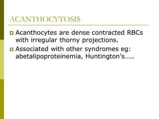 4_DISORDERS OF THE RED CELL MEMBRANE.pptx