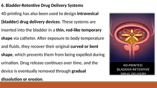 6. Bladder-Retentive Drug Delivery Systems
4D printing has also been used to design intravesical
(bladder) drug delivery devices. These systems are
inserted into the bladder in a thin, rod-like temporary
shape via catheter. After exposure to body temperature
and fluids, they recover their original curved or bent
shape, which prevents them from being expelled during
urination. Drug release continues over time, and the
device is eventually removed through gradual
dissolution or erosion.
 