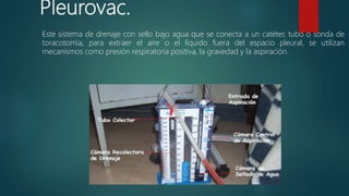 Pleurovac.
Este sistema de drenaje con sello bajo agua que se conecta a un catéter, tubo o sonda de
toracotomía, para extraer el aire o el líquido fuera del espacio pleural, se utilizan
mecanismos como presión respiratoria positiva, la gravedad y la aspiración.
 