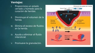 Ventajas:
I. Proporciona un estado
cerrado y húmedo para la
curación de heridas.
II. Disminuye el volumen de la
herida.
III. Elimina el exceso de fluidos
en la herida.
IV. Ayuda a eliminar el fluido
intersticial.
V. Promueve la granulación.
 