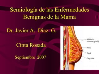 Semiología de las Enfermedades Benignas de la Mama ,[object Object],[object Object],[object Object]