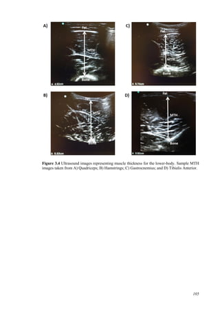 105
Figure 3.4 Ultrasound images representing muscle thickness for the lower-body. Sample MTH
images taken from A) Quadriceps; B) Hamstrings; C) Gastrocnemius; and D) Tibialis Anterior.
 