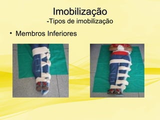 ImobilizaçãoImobilização
--Tipos de imobilização
• Membros Inferiores
 
