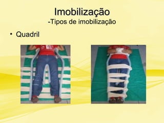 ImobilizaçãoImobilização
--Tipos de imobilização
• Quadril
 