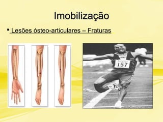ImobilizaçãoImobilização
 Lesões ósteo-articulares – Fraturas
 