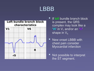 4 ECG MADE EXTRA EASY 3.powerpoint presentation | PPTX
