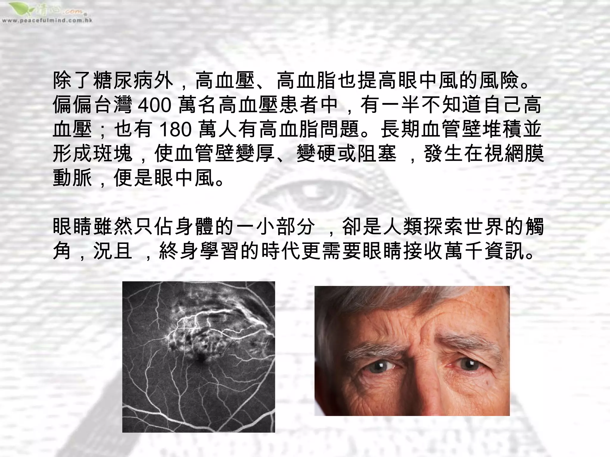 除了糖尿病外，高血壓、高血脂也提高眼中風的風險。
偏偏台灣 400 萬名高血壓患者中，有一半不知道自己高
血壓；也有 180 萬人有高血脂問題。長期血管壁堆積並
形成斑塊，使血管壁變厚、變硬或阻塞 ，發生在視網膜
動脈，便是眼中風。

眼睛雖然只佔身體的一小部分 ，卻是人類探索世界的觸
角，況且 ，終身學習的時代更需要眼睛接收萬千資訊。 
 