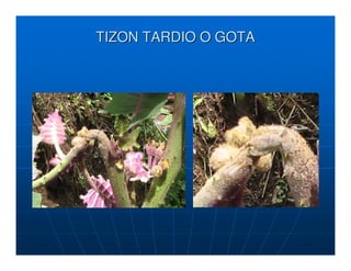 TIZON TARDIO O GOTA
 