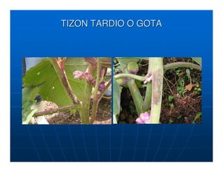 TIZON TARDIO O GOTA
 
