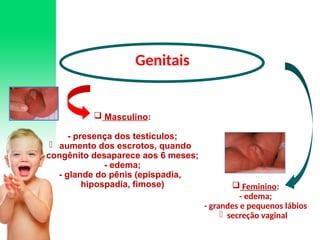  Masculino:
- presença dos testículos;
- aumento dos escrotos, quando
congênito desaparece aos 6 meses;
- edema;
- glande do pênis (epispadia,
hipospadia, fimose)
Genitais
 Feminino:
- edema;
- grandes e pequenos lábios
- secreção vaginal
 