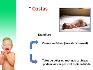 • Costas
Examinar:
Coluna vertebral (curvatura normal)
Tufos de pêlos ou rupturas cutâneas
podem indicar possível espinha bífida
 