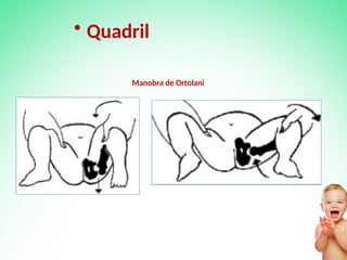 • Quadril
Manobra de Ortolani
 