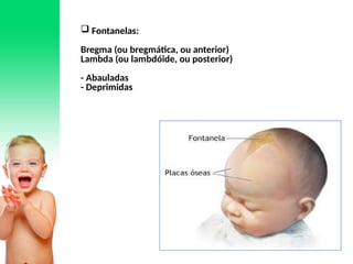  Fontanelas:
Bregma (ou bregmática, ou anterior)
Lambda (ou lambdóide, ou posterior)
- Abauladas
- Deprimidas
 