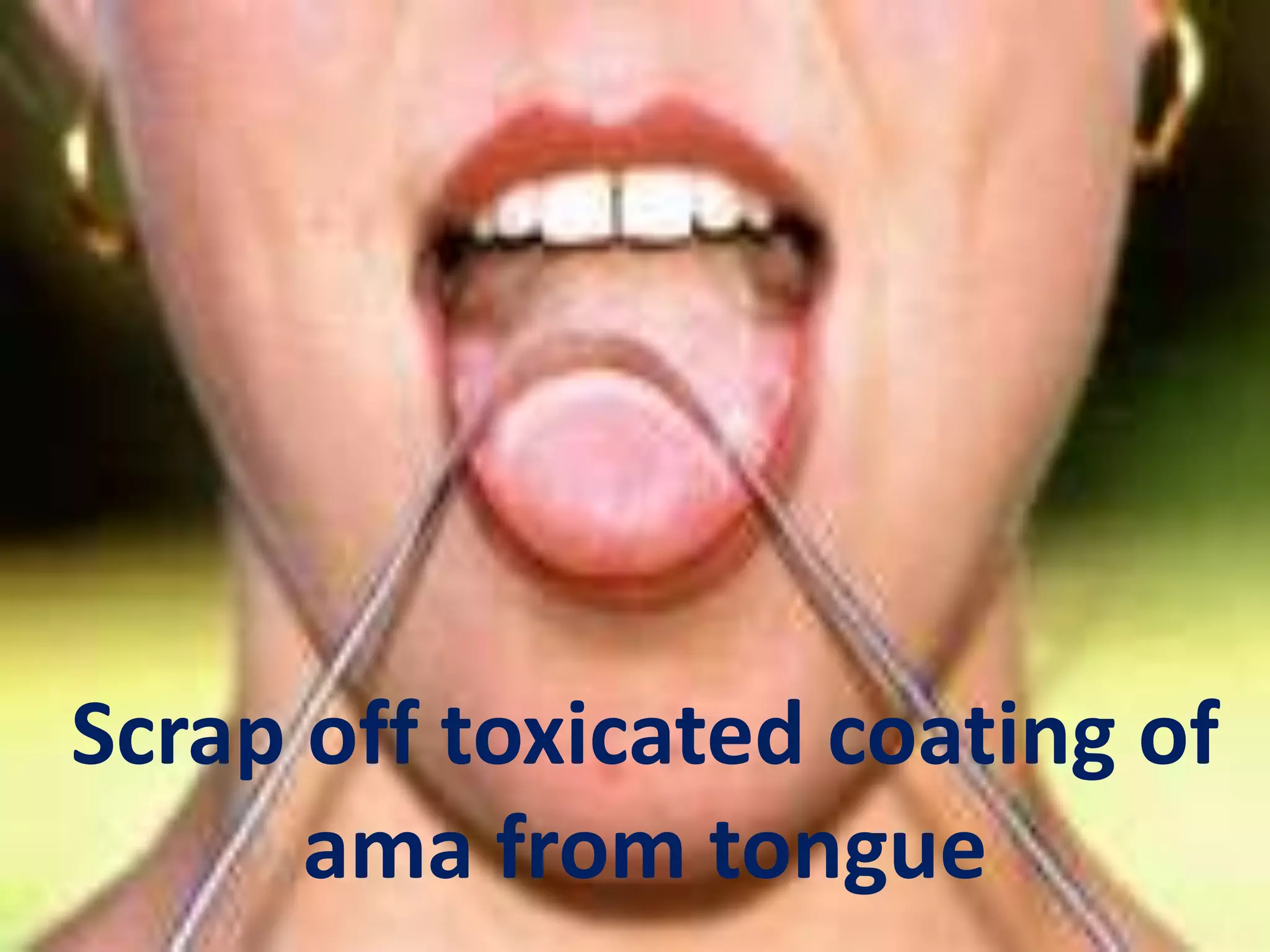 Scrap off toxicated coating of
ama from tongue
 