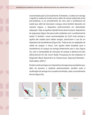 recomendada pelo CLSI atualmente. Entretanto, a coleta com seringa
pré-analíticos, é um procedimento de risco para o profissional de
saúde que, além de manusear o sangue, deve também descartar, de
maneira segura, o dispositivo perfurocortante em descartador
adequado. Hoje as agulhas hipodérmicas devem possuir dispositivos
de segurança (figura 3a) para evitar acidentes com o profissional de
saúde. E também, novas recomendações do CLSI onde seringa e
agulha são usadas para coletar sangue, preconizam o uso de um
dispositivo de transferência (Figura 3b). Trata-se de um adaptador de
coleta de sangue a vácuo, com agulha distal acoplada para a
transferência do sangue da seringa diretamente para o tubo (figura
3c), sem a necessidade de manuseio do sangue e abertura do tubo
(NCCLS/CLSI H3- A6, Vol.27 No26, Procedures for the Collection of
Diagnostic Blood Specimens by Venipuncture; Approved Standard -
Sixth edition, 2007).1
Existem ainda seringas com dispositivos de segurança acoplados que,
além de prevenir o acidente perfurocortante, também evita a
reutilização da seringa com a quebra do êmbolo, após o procedimento
técnico (figura 3d).
PREVENÇÃO DE ACIDENTES POR MATERIAL PERFUROCORTANTE NO LABORATÓRIO CLÍNICO
23
Figura 3a Figura 3b Figura 3c Figura 3d
e agulha é usada há muitos anos e além de causar potenciais erros
 