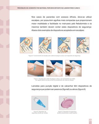 Nos casos de pacientes com acessos difíceis, deve-se utilizar
escalpes, por possuírem agulhas mais compactas que proporcionam
maior mobilidade e facilidade no manuseio pelo flebotomista e os
mesmos também devem conter estes dispositivos de segurança:
Abaixo dois exemplos de dispositivos acoplados em escalpes:
PREVENÇÃO DE ACIDENTES POR MATERIAL PERFUROCORTANTE NO LABORATÓRIO CLÍNICO
25
Figura 6. Funcionamento de escalpe para coleta de sangue a vácuo com dispositivo de segurança.
Figura 7. Escalpe para coleta de sangue a vácuo, com acionamento por botão,
com agulha dentro da veia ao final do procedimento de coleta de sangue.
Lancetas para punção digital e de calcanhar têm dispositivos de
segurança que podem ser passivos (figura8) ou ativos (figura 9)
Figura 8. Dispositivo de
segurança ativado por contato.
Figura 9. Dispositivo de segurança
ativado pressionando a parte superior.
 
