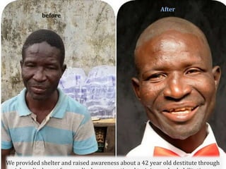 We provided shelter and raised awareness about a 42 year old destitute through
before
After
 