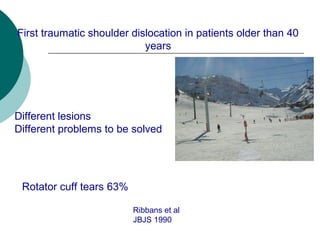 Findings after 1st
shoulder dislocation
in skiers older than 40 years
 52 pts follow up more than 2 years
 Redislocation...