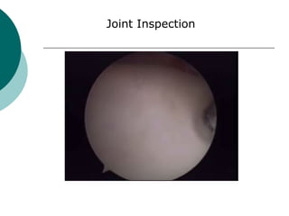 Joint Inspection
 