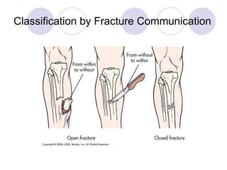 Classification by Fracture Communication 