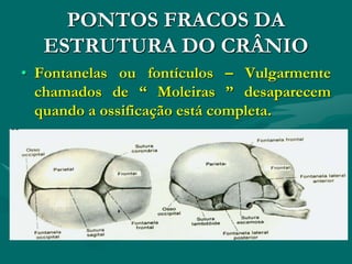 PONTOS FRACOS DA
ESTRUTURA DO CRÂNIO
• Fontanelas ou fontículos – Vulgarmente
chamados de “ Moleiras ” desaparecem
quando a ossificação está completa.
 
