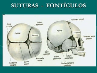 SUTURAS - FONTÍCULOS
 