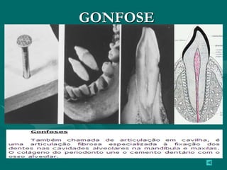 GONFOSE
 