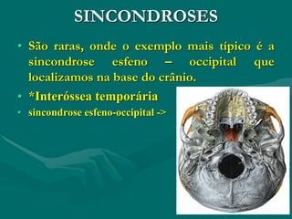 SINCONDROSES
• São raras, onde o exemplo mais típico é a
sincondrose esfeno – occipital que
localizamos na base do crânio.
• *Interóssea temporária
• sincondrose esfeno-occipital ->
 