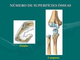 Simples
Composta
NÚMERO DE SUPERFÍCIES ÓSSEAS
 