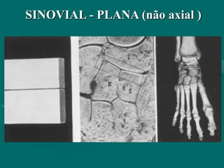 SINOVIAL - PLANA (não axial )
 