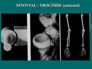 SINOVIAL - TROCÓIDE (uniaxial)
 