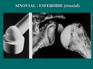 SINOVIAL - ESFERÓIDE (triaxial)
 