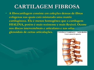 CARTILAGEM FIBROSA
• A fibrocartilagem consiste em coleções densas de fibras
colágenas nas quais está misturada uma matriz
cartilaginosa. Ela é menos homogênea que a cartilagem
HIALINA, porém é mais resistente e mais flexível. Ocorre
nos discos intervertebrais e articulares e nas orlas
glenoidais de certas articulações.
 