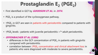 JensMartensson
Prostaglandin E2 (PGE2)
49
• First identified in GCF by GOODSON ET AL. in 1974.
• PGE2 is a product of the cyclooxygenase pathway.
• ↑PGE2 in GCF are seen in patients with periodontitis compared to patients with
gingivitis.
• ↑PGE2 levels : patients with juvenile periodontitis >3x adult periodontitis.
• OFFENBACHER ET AL (1986)
• differences in the GCF concentration of PGE2 in patients with gingivitis
compared with periodontitis.
• correlation between ↑PGE2 concentration and clinical attachment loss in
patients who were diagnosed with moderate to severe periodontitis.
 