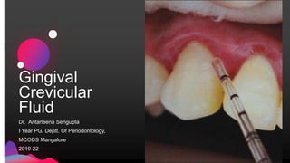 Gingival
Crevicular
Fluid
Dr. Antarleena Sengupta
I Year PG, Deptt. Of Periodontology,
MCODS Mangalore
2019-22
 