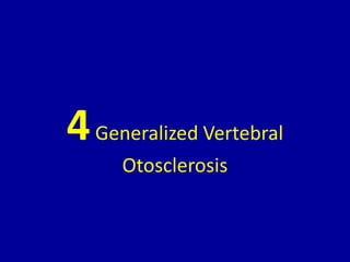 4Generalized Vertebral
Otosclerosis
 