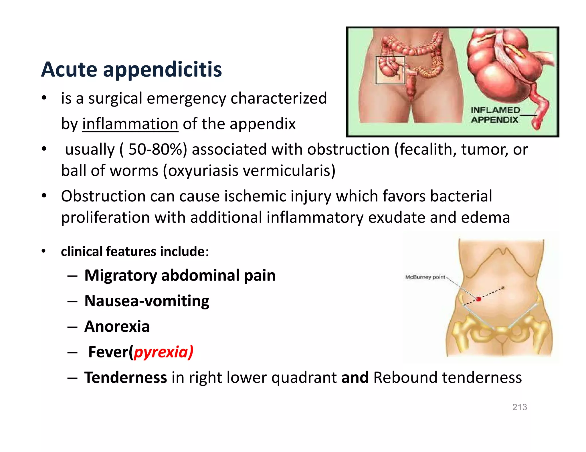 Acute appendicitis
• is a surgical emergency characterized
by inflammation of the appendix
• usually ( 50-80%) associated with obstruction (fecalith, tumor, or
ball of worms (oxyuriasis vermicularis)
• Obstruction can cause ischemic injury which favors bacterial
proliferation with additional inflammatory exudate and edema
• clinical features include:
– Migratory abdominal pain
– Nausea-vomiting
– Anorexia
– Fever(pyrexia)
– Tenderness in right lower quadrant and Rebound tenderness
Acute appendicitis
• is a surgical emergency characterized
by inflammation of the appendix
• usually ( 50-80%) associated with obstruction (fecalith, tumor, or
ball of worms (oxyuriasis vermicularis)
• Obstruction can cause ischemic injury which favors bacterial
proliferation with additional inflammatory exudate and edema
• clinical features include:
– Migratory abdominal pain
– Nausea-vomiting
– Anorexia
– Fever(pyrexia)
– Tenderness in right lower quadrant and Rebound tenderness
213
 