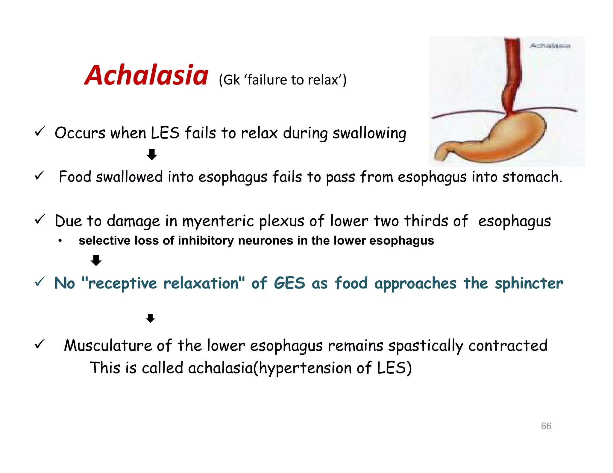 Achalasia (Gk ‘failure to relax’)
 Occurs when LES fails to relax during swallowing

 Food swallowed into esophagus fails to pass from esophagus into stomach.
 Due to damage in myenteric plexus of lower two thirds of esophagus
• selective loss of inhibitory neurones in the lower esophagus

 No "receptive relaxation" of GES as food approaches the sphincter

 Musculature of the lower esophagus remains spastically contracted
This is called achalasia(hypertension of LES)
 Occurs when LES fails to relax during swallowing

 Food swallowed into esophagus fails to pass from esophagus into stomach.
 Due to damage in myenteric plexus of lower two thirds of esophagus
• selective loss of inhibitory neurones in the lower esophagus

 No "receptive relaxation" of GES as food approaches the sphincter

 Musculature of the lower esophagus remains spastically contracted
This is called achalasia(hypertension of LES)
66
 