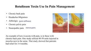 DPT - Microbiology II (Gram +ve Spore forming rods) | PPTX