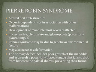  Altered first arch structure
 Occur independently or in association with other
malformations
 Development of mandible most severely affected
 micrognathia, cleft palate and glossoptosis (posteriorly
placed tongue)
 Robin’s syndrome may be due to genetic or environmental
factors
 May also occur as a deformation
 The primary defect includes poor growth of the mandible
and as a result a posteriorly placed tongue that fails to drop
from between the palatal shelves preventing their fusion
 