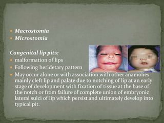  Macrostomia
 Microstomia
Congenital lip pits:
 malformation of lips
 Following heridetary pattern
 May occur alone or with association with other anamolies
mainly cleft lip and palate due to notching of lip at an early
stage of development with fixation of tissue at the base of
the notch or from failure of complete union of embryonic
lateral sulci of lip which persist and ultimately develop into
typical pit.
 