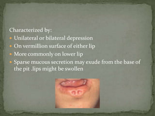 Characterized by:
 Unilateral or bilateral depression
 On vermillion surface of either lip
 More commonly on lower lip
 Sparse mucous secretion may exude from the base of
the pit .lips might be swollen
 