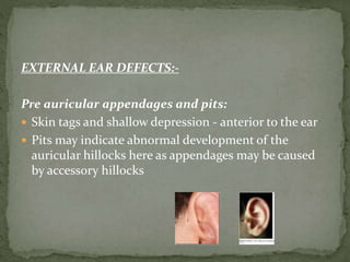 EXTERNAL EAR DEFECTS:-
Pre auricular appendages and pits:
 Skin tags and shallow depression - anterior to the ear
 Pits may indicate abnormal development of the
auricular hillocks here as appendages may be caused
by accessory hillocks
 