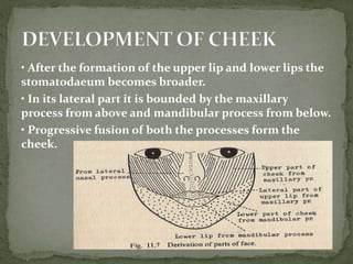 • After the formation of the upper lip and lower lips the
stomatodaeum becomes broader.
• In its lateral part it is bounded by the maxillary
process from above and mandibular process from below.
• Progressive fusion of both the processes form the
cheek.
 